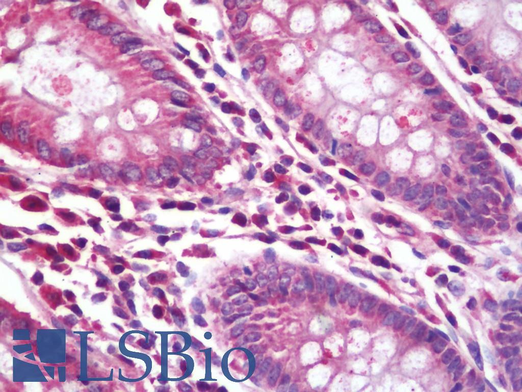 RPL5 / Ribosomal Protein L5 Antibody - Anti-RPL5 / L5 antibody IHC staining of human colon. Immunohistochemistry of formalin-fixed, paraffin-embedded tissue after heat-induced antigen retrieval. Antibody concentration 20 ug/ml. This image was taken for the unconjugated form of this product. Other forms have not been tested.