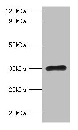 RPL5 / Ribosomal Protein L5 Antibody - Western blot All lanes: 60S ribosomal protein L5 polyclonal antibody at 2µg/ml + EC109 whole cell lysate Secondary Goat polyclonal to rabbit IgG at 1/15000 dilution Predicted band size: 32.7 kDa Observed band size: 32.7 kDa