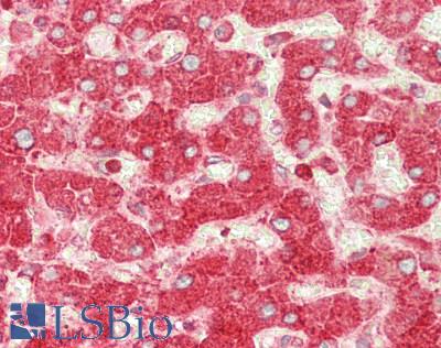 RPL7 / Ribosomal Protein L7 Antibody - Human Liver: Formalin-Fixed, Paraffin-Embedded (FFPE)
