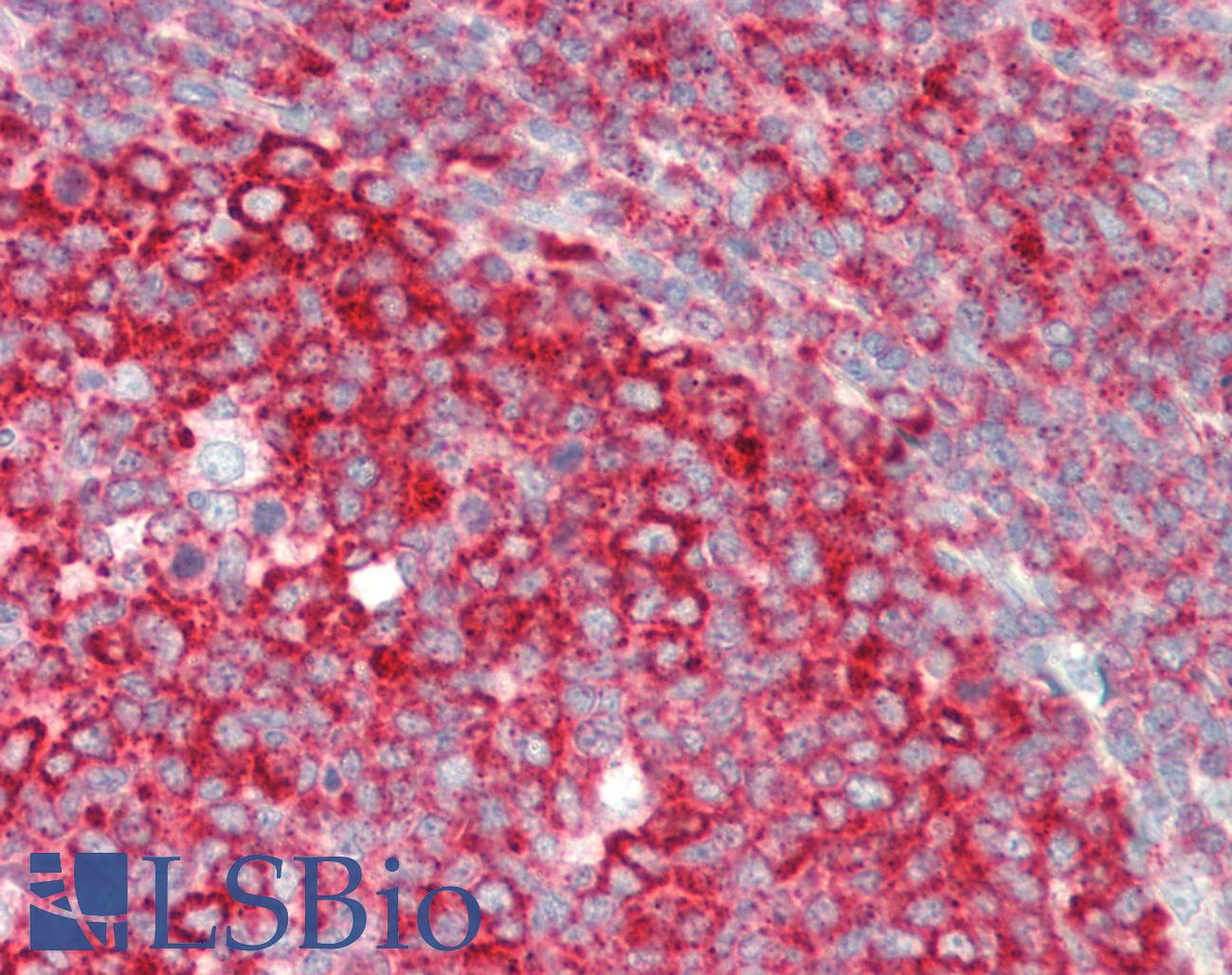 RPL7A / Ribosomal Protein L7a Antibody - Human Tonsil: Formalin-Fixed, Paraffin-Embedded (FFPE)