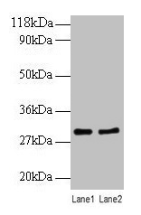 RPL8 / Ribosomal Protein L8 Antibody - Western blot All lanes: 60S ribosomal protein L8 antibody at 2µg/ml Lane 1: EC109 whole cell lysate Lane 2: 293T whole cell lysate Secondary Goat polyclonal to rabbit IgG at 1/10000 dilution Predicted band size: 28 kDa Observed band size: 28 kDa