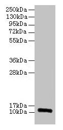 RPLP1 Antibody - Western blot All lanes: 60S acidic ribosomal protein P1 antibody at 2µg/ml Lane 1: EC109 whole cell lysate Lane 2: 293T whole cell lysate Secondary Goat polyclonal to rabbit IgG at 1/15000 dilution Predicted band size: 12, 9 kDa Observed band size: 12, 60 kDa