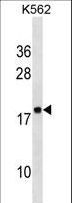 RPLP2 Antibody - RPLP2 Antibody western blot of K562 cell line lysates (35 ug/lane). The RPLP2 antibody detected the RPLP2 protein (arrow).