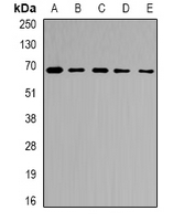 RPN2 / Ribophorin II Antibody - Western blot analysis of Ribophorin-2 expression in Jurkat (A); MCF7 (B); NIH3T3 (C); mouse liver (D); rat liver (E) whole cell lysates.