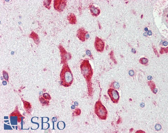 RPS12 / Ribosomal Protein S12 Antibody - Anti-RPS12 / S12 antibody IHC staining of human brain, cortex. Immunohistochemistry of formalin-fixed, paraffin-embedded tissue after heat-induced antigen retrieval. Antibody dilution 1:100.