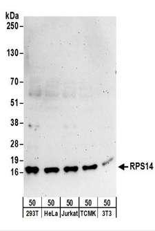 RPS14 / Ribosomal Protein S14 Antibody - Detection of Human and Mouse RPS14 by Western Blot. Samples: Whole cell lysate (50 ug) from 293T, HeLa, Jurkat, mouse TCMK-1, and mouse NIH3T3 cells. Antibodies: Affinity purified rabbit anti-RPS14 antibody used for WB at 0.1 ug/ml. Detection: Chemiluminescence with an exposure time of 3 minutes.