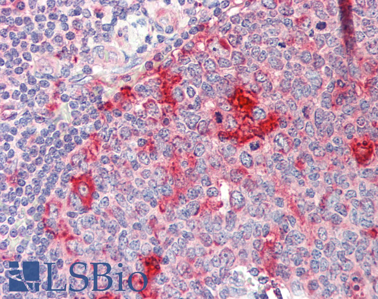 RPS14 / Ribosomal Protein S14 Antibody - Anti-RPS14 / S14 antibody IHC staining of human tonsil. Immunohistochemistry of formalin-fixed, paraffin-embedded tissue after heat-induced antigen retrieval. Antibody concentration 20 ug/ml. This image was taken for the unconjugated form of this product. Other forms have not been tested.