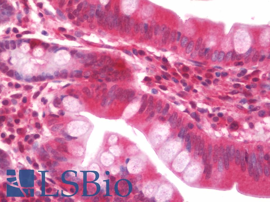 RPS16 / Ribosomal Protein S16 Antibody - Anti-RPS16 / S16 antibody IHC staining of human small intestine. Immunohistochemistry of formalin-fixed, paraffin-embedded tissue after heat-induced antigen retrieval. Antibody concentration 10 ug/ml.  This image was taken for the unconjugated form of this product. Other forms have not been tested.