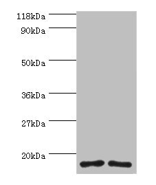 RPS16 / Ribosomal Protein S16 Antibody - Western blot All lanes: RPS16 protein antibody at 2µg/ml Lane 1: 293T whole cell lysate Lane 2: EC109 whole cell lysate Secondary Goat polyclonal to rabbit IgG at 1/15000 dilution Predicted band size: 17 kDa Observed band size: 17 kDa
