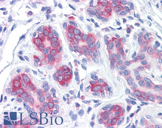RPS2 / Ribosomal Protein S2 Antibody - Anti-RPS2 antibody IHC of human breast. Immunohistochemistry of formalin-fixed, paraffin-embedded tissue after heat-induced antigen retrieval. Antibody concentration 5 ug/ml.
