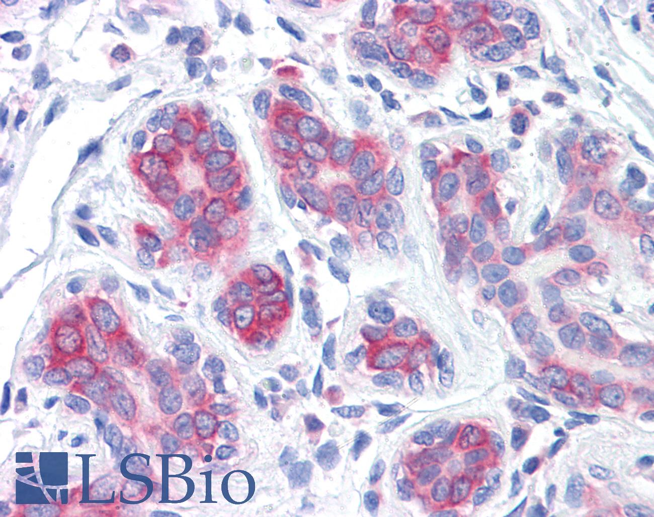 RPS2 / Ribosomal Protein S2 Antibody - Anti-RPS2 antibody IHC of human breast. Immunohistochemistry of formalin-fixed, paraffin-embedded tissue after heat-induced antigen retrieval. Antibody concentration 5 ug/ml.