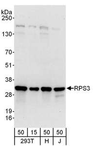RPS3 / Ribosomal Protein S3 Antibody - Detection of Human RPS3 by Western Blot. Samples: Whole cell lysate from 293T (15 and 50 ug), HeLa (H; 50 ug) and Jurkat (J; 50 ug) cells. Antibodies: Affinity purified rabbit anti-RPS3 antibody used for WB at 0.1 ug/ml. Detection: Chemiluminescence with an exposure time of 10 seconds.