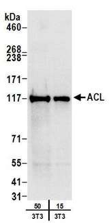 RPS3 / Ribosomal Protein S3 Antibody - Detection of mouse ACL by western blot. Samples: Whole cell lysate (15 and 50 µg) from mouse NIH 3T3 cells. Antibodies: Affinity purified rabbit anti-ACL antibody used for WB at 0.4 µg/ml. Detection: Chemiluminescence with an exposure time of 10 seconds.