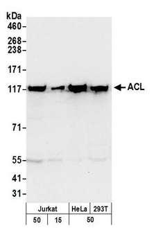 RPS3 / Ribosomal Protein S3 Antibody - Detection of human ACL by western blot. Samples: Whole cell lysate from Jurkat (15 and 50 µg), HeLa (50µg), and HEK293T (50µg) cells. Antibodies: Affinity purified rabbit anti-ACL antibody used for WB at 0.4 µg/ml. Detection: Chemiluminescence with an exposure time of 30 seconds.