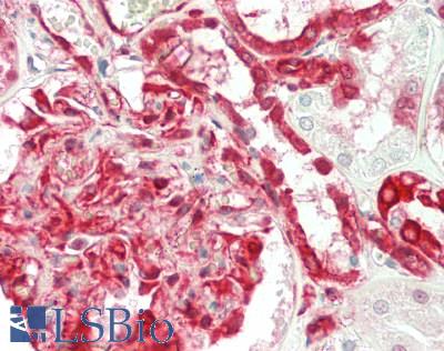 RPS3 / Ribosomal Protein S3 Antibody - Human Kidney: Formalin-Fixed, Paraffin-Embedded (FFPE)