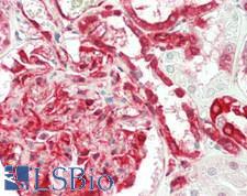 RPS3 / Ribosomal Protein S3 Antibody - Human Kidney: Formalin-Fixed, Paraffin-Embedded (FFPE)