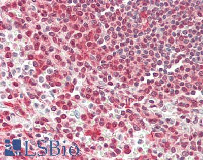 RPS3 / Ribosomal Protein S3 Antibody - Human Spleen: Formalin-Fixed, Paraffin-Embedded (FFPE)