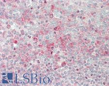 RPS4X + RPS4Y1 + RPS Antibody - Human Tonsil: Formalin-Fixed, Paraffin-Embedded (FFPE)