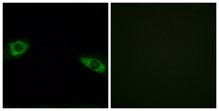 RPS4X + RPS4Y1 + RPS Antibody - Immunofluorescence analysis of HUVEC cells, using RPS4Y1 Antibody. The picture on the right is blocked with the synthesized peptide.