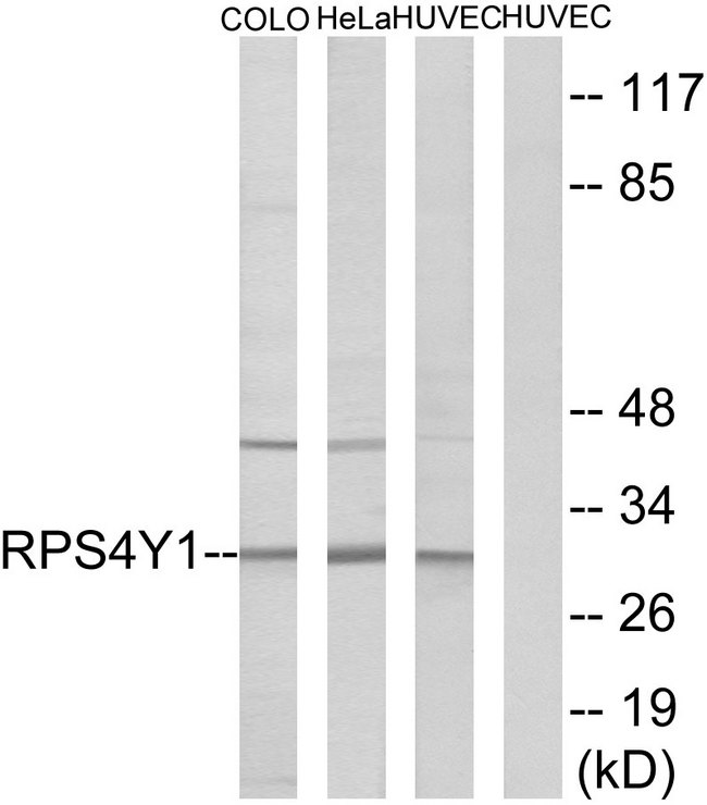 RPS4X + RPS4Y1 + RPS Antibody - Western blot analysis of lysates from HUVEC, HeLa, and COLO cells, using RPS4Y1 Antibody. The lane on the right is blocked with the synthesized peptide.