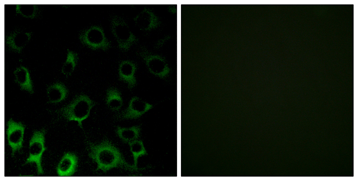RPS4X + RPS4Y1 + RPS Antibody - Immunofluorescence analysis of HUVEC cells, using RPS4X Antibody. The picture on the right is blocked with the synthesized peptide.