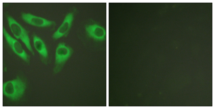RPS6 / Ribosomal Protein S6 Antibody - Immunofluorescence analysis of HeLa cells, using S6 Ribosomal Protein Antibody. The picture on the right is blocked with the synthesized peptide.