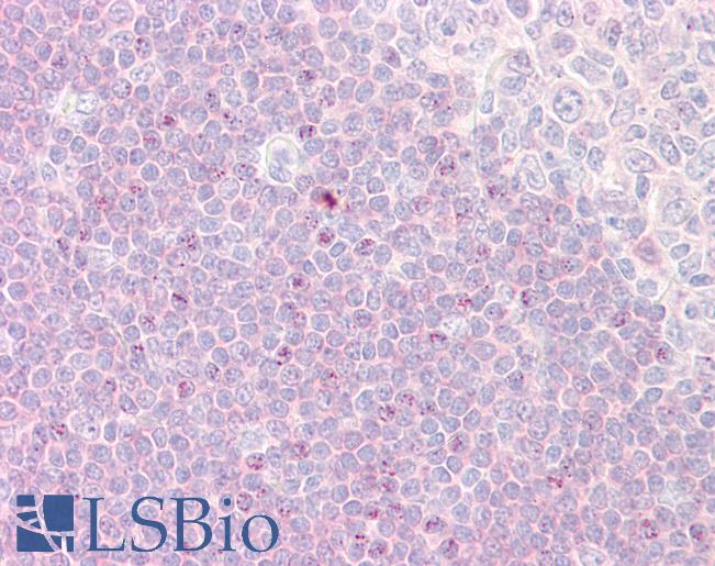 RPS6KA1 / RSK1 Antibody - Anti-RPS6KA1 / RSK1 antibody IHC of human tonsil. Immunohistochemistry of formalin-fixed, paraffin-embedded tissue after heat-induced antigen retrieval. Antibody dilution 1:100.