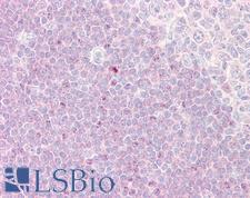 RPS6KA1 / RSK1 Antibody - Anti-RPS6KA1 / RSK1 antibody IHC of human tonsil. Immunohistochemistry of formalin-fixed, paraffin-embedded tissue after heat-induced antigen retrieval. Antibody dilution 1:100.
