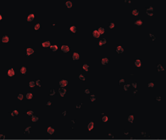 RPS6KA1 / RSK1 Antibody - Immunofluorescence of RP S6 Kinase in Jurkat cells with RP S6 Kinase antibody at 20 ug/ml.
