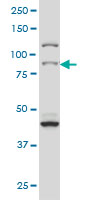 RPS6KA2 / RSK3 Antibody - Western blot of RPS6KA2 expression in HeLa NE.
