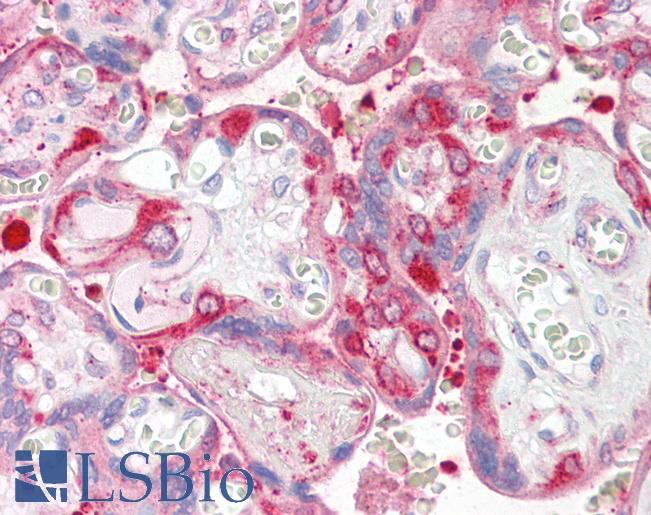 RPS6KA3 / RSK2 Antibody - Anti-RPS6KA3 / RSK2 antibody IHC of human placenta. Immunohistochemistry of formalin-fixed, paraffin-embedded tissue after heat-induced antigen retrieval. Antibody dilution 1:100.