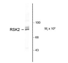 RPS6KA3 / RSK2 Antibody - Western blot of HeLa cell lysate showing specific immunolabeling of the ~90k RSK2 protein.