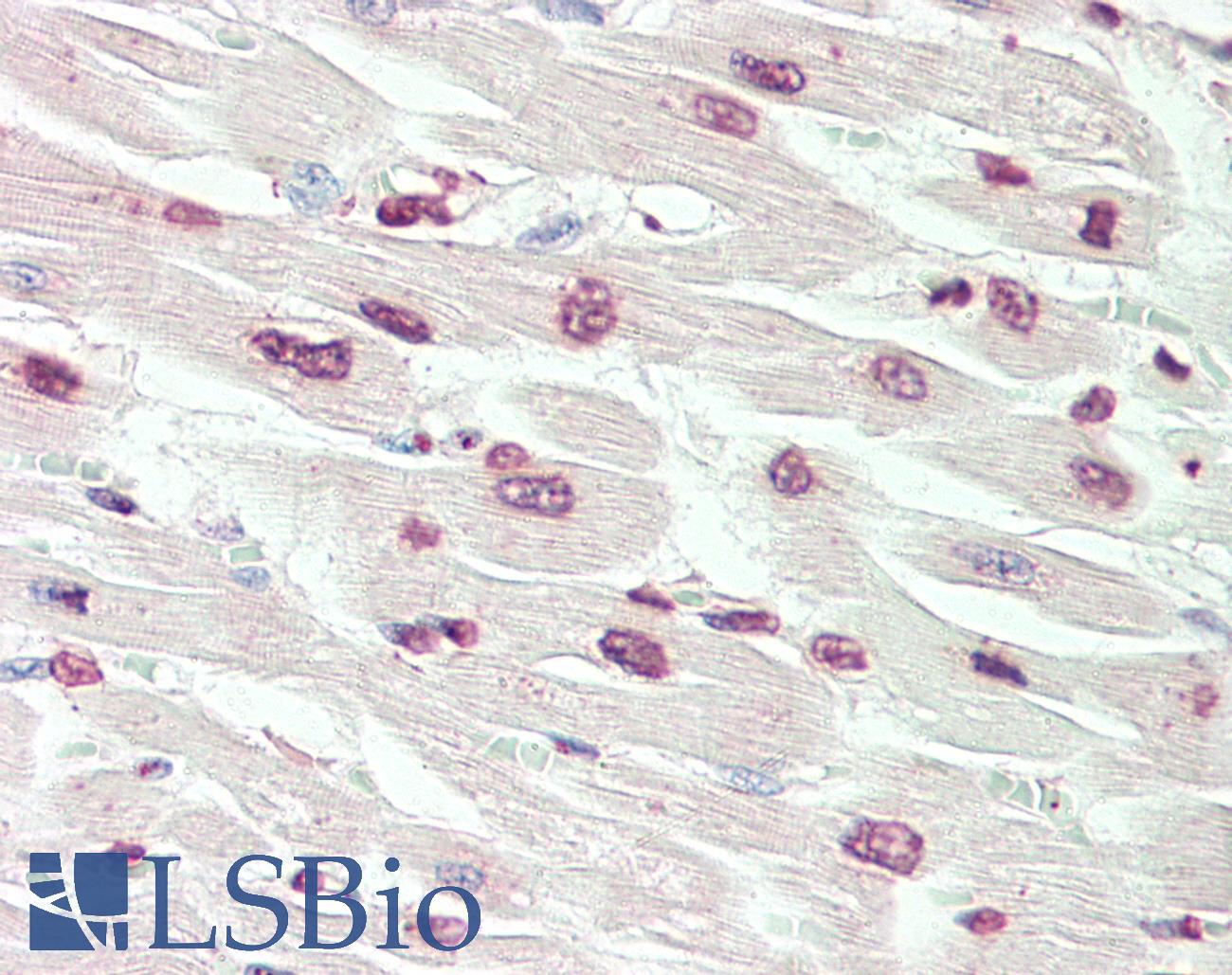 RPS6KA3 / RSK2 Antibody - Anti-RPS6KA3 / RSK2 antibody IHC staining of human heart. Immunohistochemistry of formalin-fixed, paraffin-embedded tissue after heat-induced antigen retrieval. Antibody dilution 1:50.