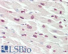 RPS6KA3 / RSK2 Antibody - Anti-RPS6KA3 / RSK2 antibody IHC staining of human heart. Immunohistochemistry of formalin-fixed, paraffin-embedded tissue after heat-induced antigen retrieval. Antibody dilution 1:50.