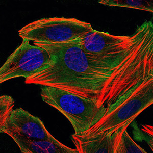RPS6KA3 / RSK2 Antibody - Immunofluorescence of HepG2 cells using RSK2 mouse monoclonal antibody (green). Blue: DRAQ5 fluorescent DNA dye. Red: Actin filaments have been labeled with Alexa Fluor-555 phalloidin.