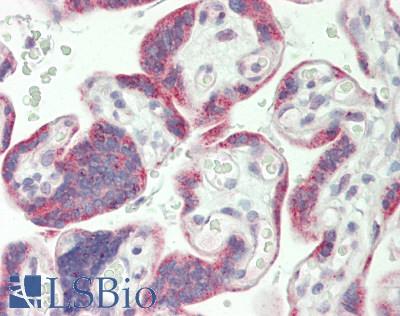 RPS6KA5 / MSK1 Antibody - Human Placenta: Formalin-Fixed, Paraffin-Embedded (FFPE)
