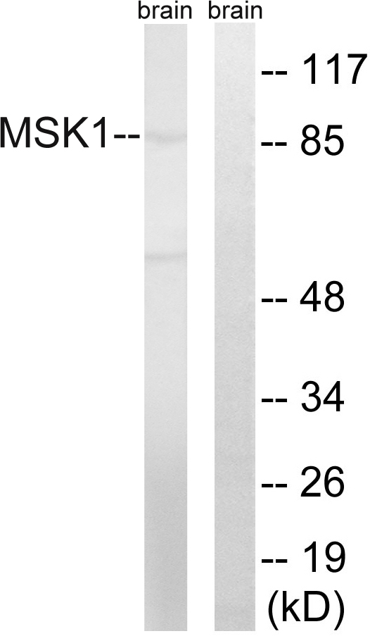 RPS6KA5 / MSK1 Antibody - Western blot analysis of lysates from mouse brain, using MSK1 Antibody. The lane on the right is blocked with the synthesized peptide.