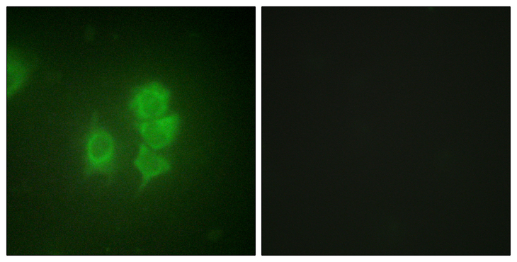RPS6KA5 / MSK1 Antibody - Immunofluorescence analysis of HUVEC cells, using MSK1 Antibody. The picture on the right is blocked with the synthesized peptide.