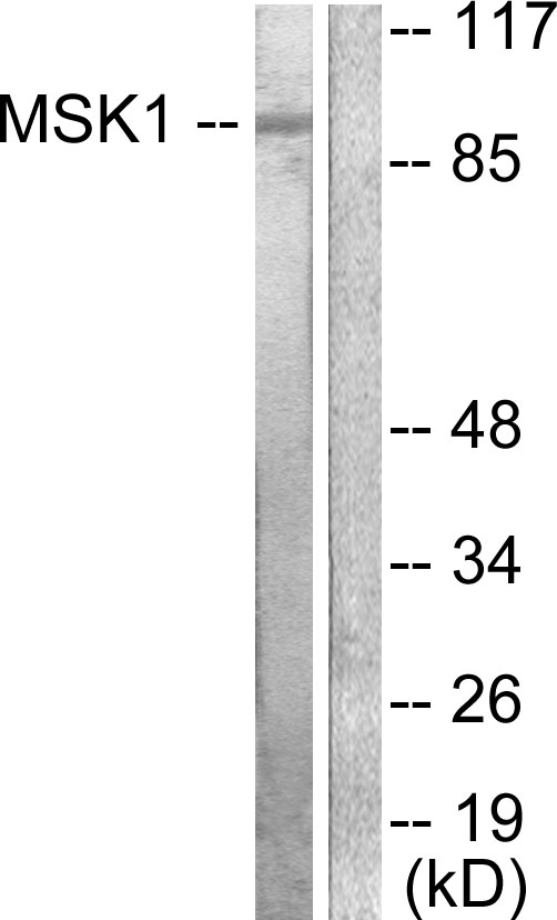 RPS6KA5 / MSK1 Antibody - Western blot analysis of lysates from 293 cells, treated with UV 15', using MSK1 Antibody. The lane on the right is blocked with the synthesized peptide.