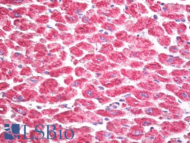 RPS6KA5 / MSK1 Antibody - Anti-RPS6KA5 / MSK1 antibody IHC of human heart. Immunohistochemistry of formalin-fixed, paraffin-embedded tissue after heat-induced antigen retrieval. Antibody dilution 5 ug/ml.