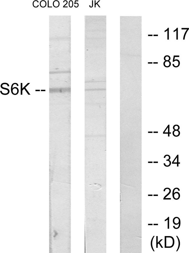 RPS6KB1 / P70S6K / S6K Antibody - Western blot analysis of lysates from COLO205 and Jurkat cells, using S6K Antibody. The lane on the right is blocked with the synthesized peptide.