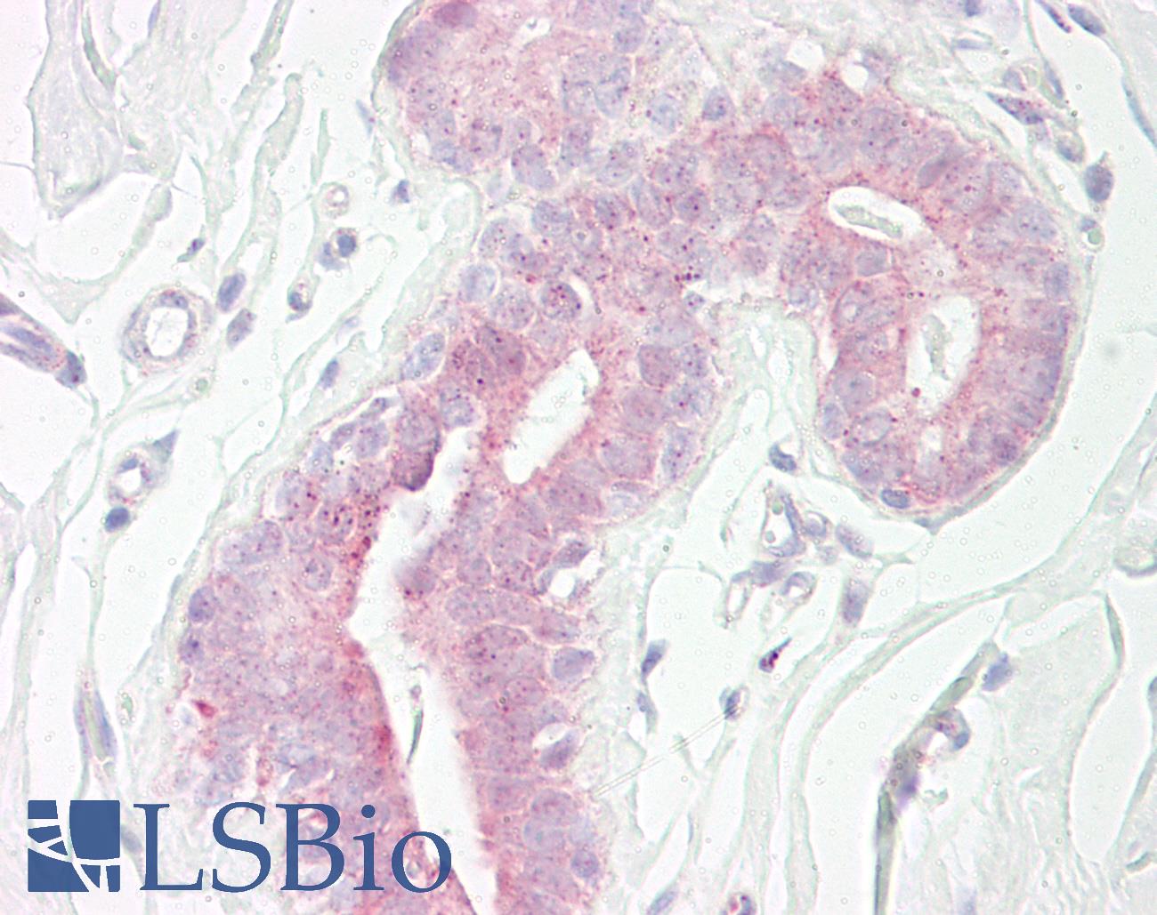 RPS6KB1 / P70S6K / S6K Antibody - Anti-RPS6KB1 / S6K antibody IHC of human breast. Immunohistochemistry of formalin-fixed, paraffin-embedded tissue after heat-induced antigen retrieval. Antibody dilution 1:100.