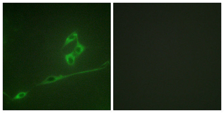 RPS6KB1 / P70S6K / S6K Antibody - Immunofluorescence analysis of NIH/3T3 cells, using p70 S6 Kinase Antibody. The picture on the right is blocked with the synthesized peptide.