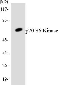 RPS6KB1 / P70S6K / S6K Antibody - Western blot analysis of the lysates from 293 cells using p70 S6 Kinase antibody.