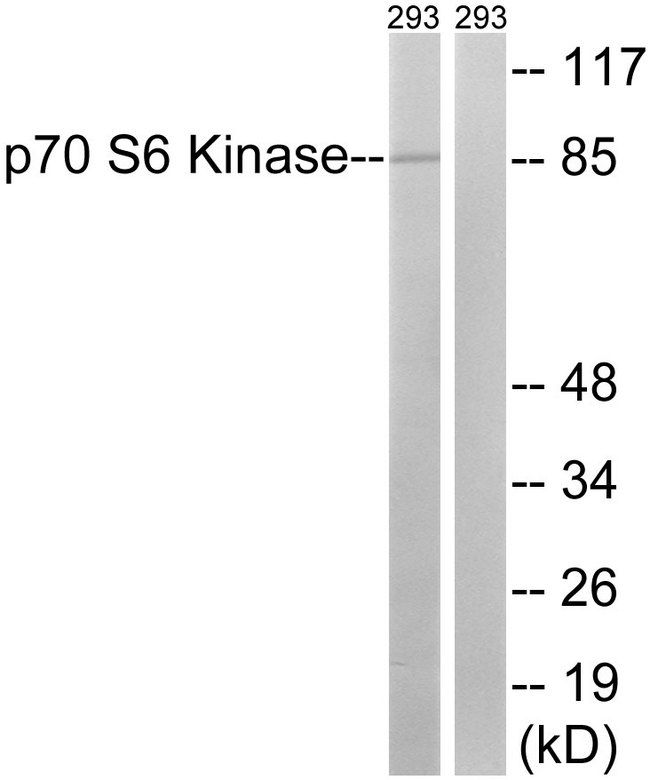 RPS6KB1 / P70S6K / S6K Antibody - Western blot analysis of lysates from 293 cells, using p70 S6 Kinase Antibody. The lane on the right is blocked with the synthesized peptide.