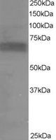 RPS6KB1 / P70S6K / S6K Antibody - RPS6KB1 antibody staining (0.2 ug/ml) of Human Muscle lysate (RIPA buffer, 35g total protein per lane). Primary incubated for 1 hour. Detected by Western blot of chemiluminescence.