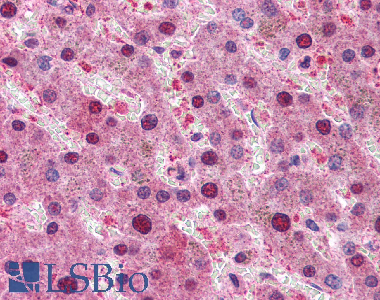 RPS6KB1 / P70S6K / S6K Antibody - Anti-RPS6KB1 / S6K antibody IHC of human liver. Immunohistochemistry of formalin-fixed, paraffin-embedded tissue after heat-induced antigen retrieval. Antibody concentration 3.75 ug/ml.
