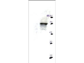 RPS6KB1 / P70S6K / S6K Antibody - Anti-p70S6K antibody - Western Blot. Western blot of Affinity Purified anti-p70S6K antibody shows detection of a predominant band corresponding to p70S6K in mouse brain extract (right lane) after immunoprecipitation. The left lane shows mock immunoprecipitation.