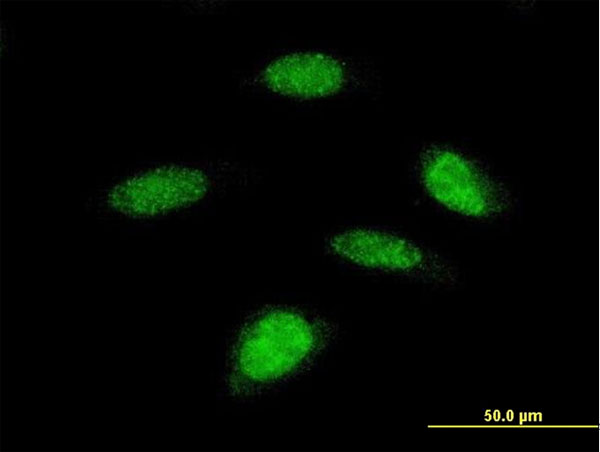 RPS6KB2 / S6K2 Antibody - Immunofluorescence of monoclonal antibody to RPS6KB2 on HeLa cell . [antibody concentration 10 ug/ml]
