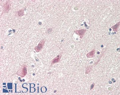 RPS6KB2 / S6K2 Antibody - Human Brain, Cortex: Formalin-Fixed, Paraffin-Embedded (FFPE)
